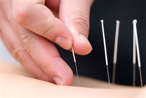 Massage Therapists and Acupuncturists at Body.